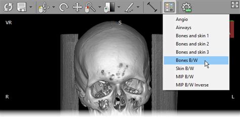 dicom stl|dicom image viewer.